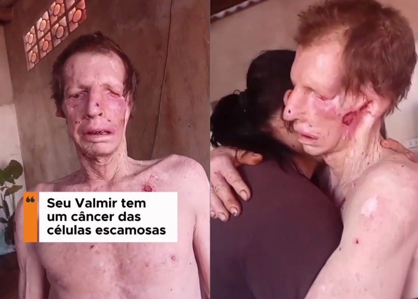 Valmir - Homem que precisa da sua ajuda para vencer o câncer